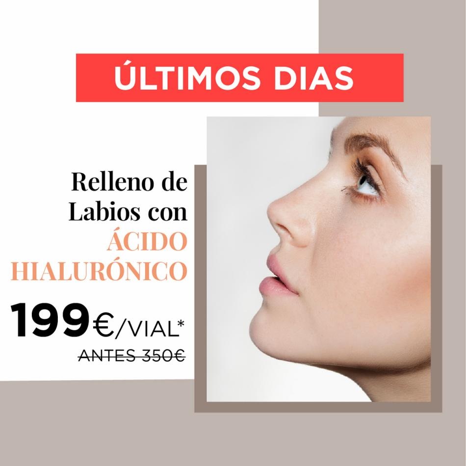 Lush canarias  Promociones especiales 